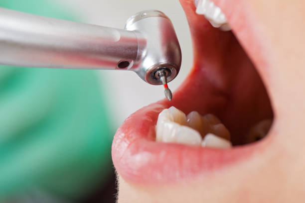 Best Tooth Pain Emergency Relief  in Tunica, MS